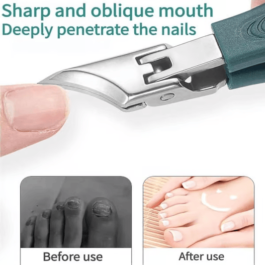 🔥 Design ergonomic unghiular pentru unghiile de la picioare și unghiile încarnate